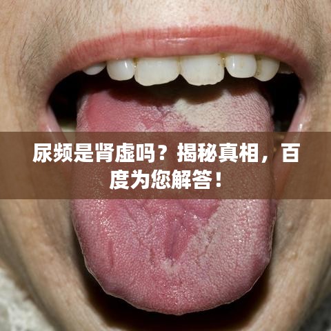 尿频是肾虚吗？揭秘真相，百度为您解答！