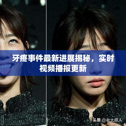 牙疼事件最新进展揭秘，实时视频播报更新