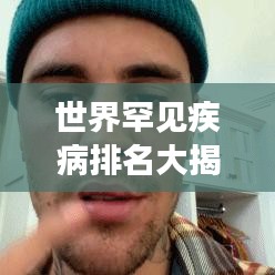世界罕见疾病排名大揭秘，症状、影响与防治知识一网打尽